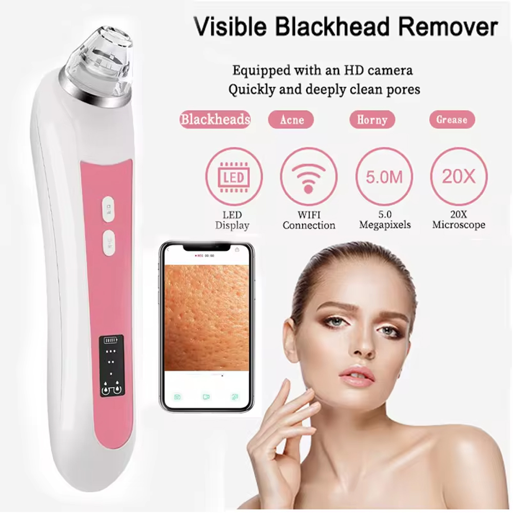 Alat perawatan kulit hidung, a - Pore Vacuum ulasan dan harga
