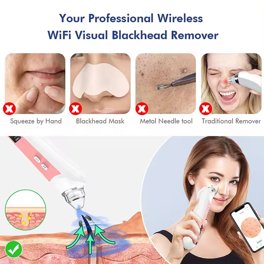 Alat perawatan kulit hidung, a - Pore Vacuum ulasan dan harga