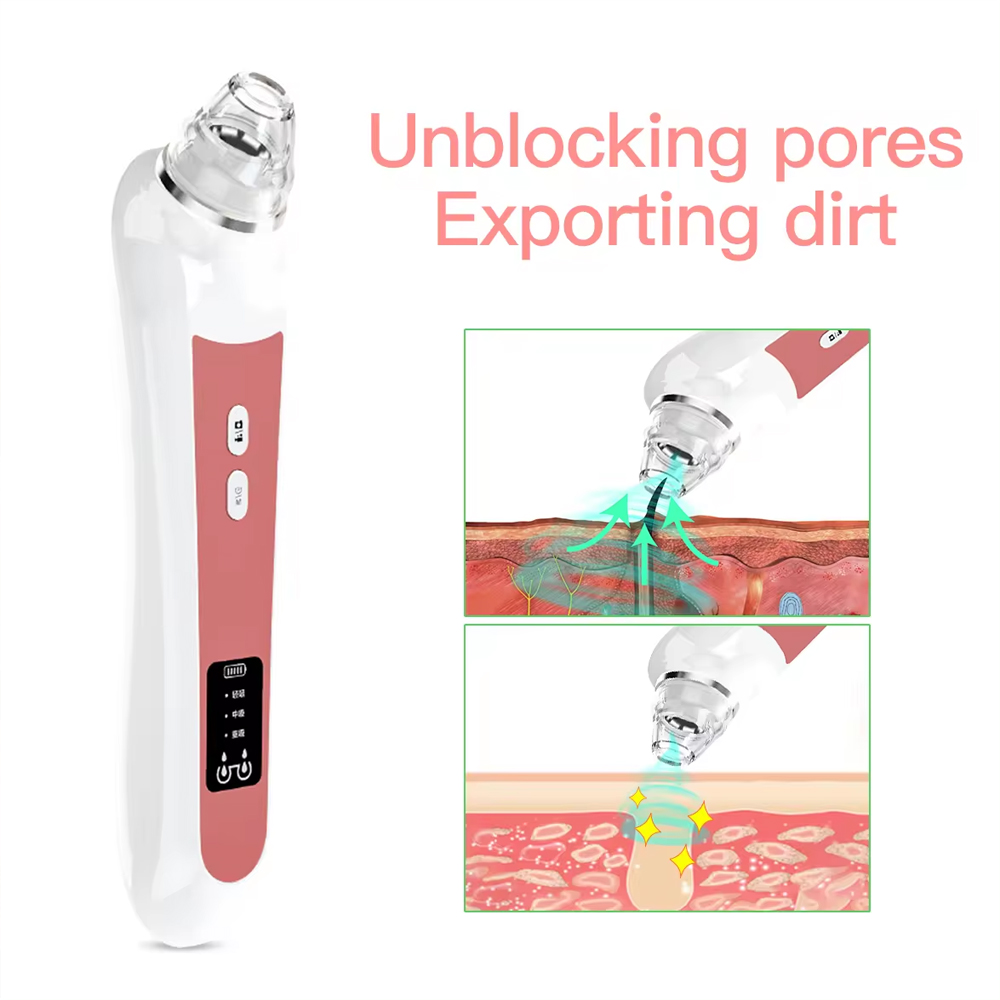 Alat perawatan kulit hidung, a - Pore Vacuum ulasan dan harga