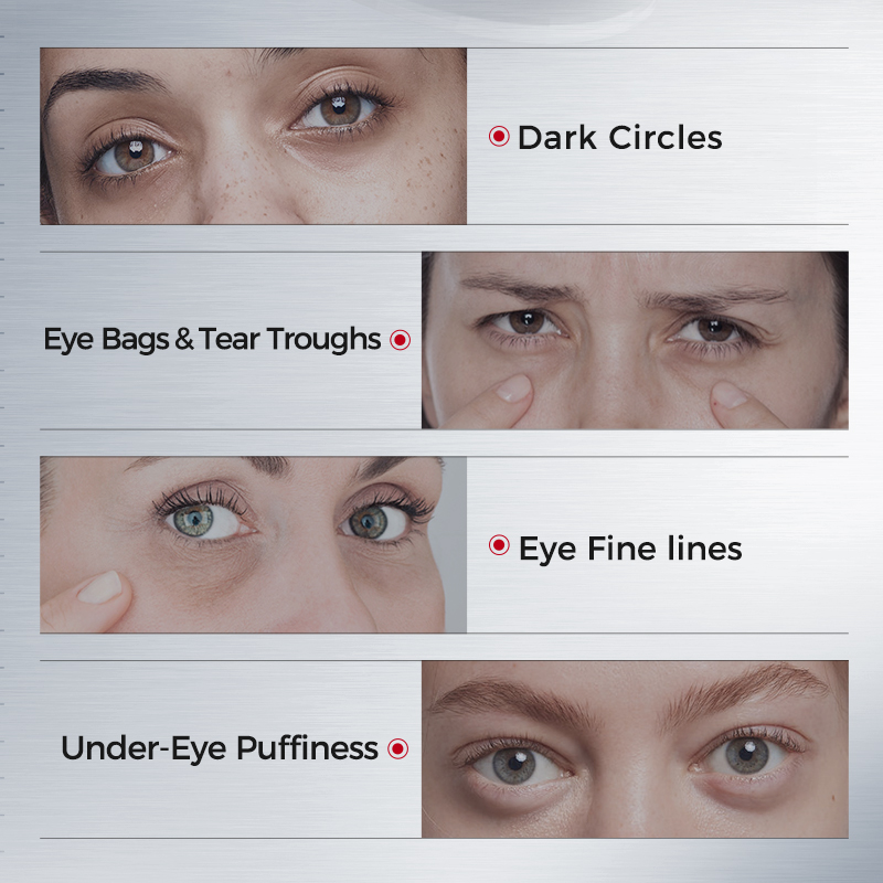 Plester Mata untuk Lingkaran H - Collagen Eye Patch ulasan dan harga