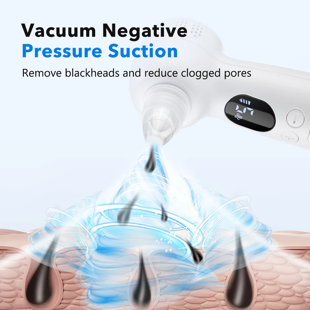 Alat Penghisap Komedo dengan K - Pore Vacuum ulasan dan harga