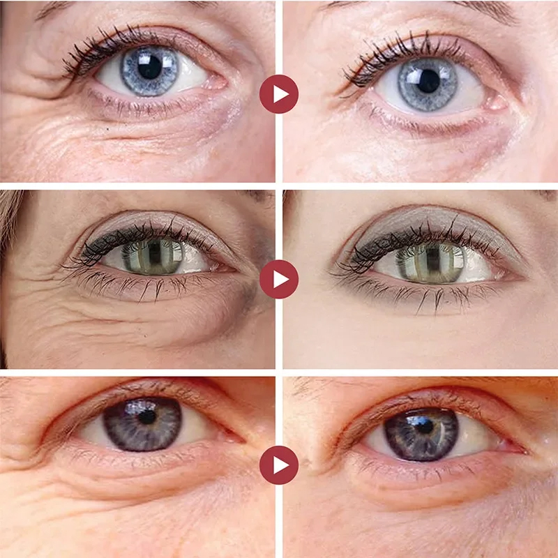 Patch Penghilang Kerutan Mata  - Collagen Eye Patch ulasan dan harga